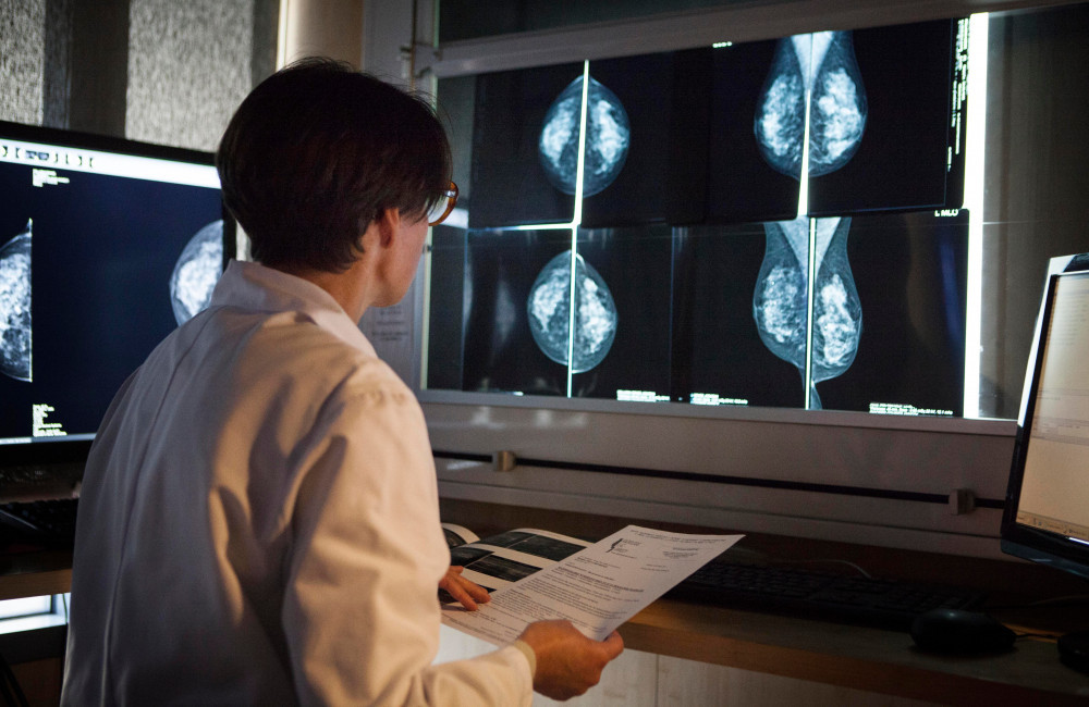L'IA permet de détecter les maladies cardiaques chez les femmes à partir de mammographies